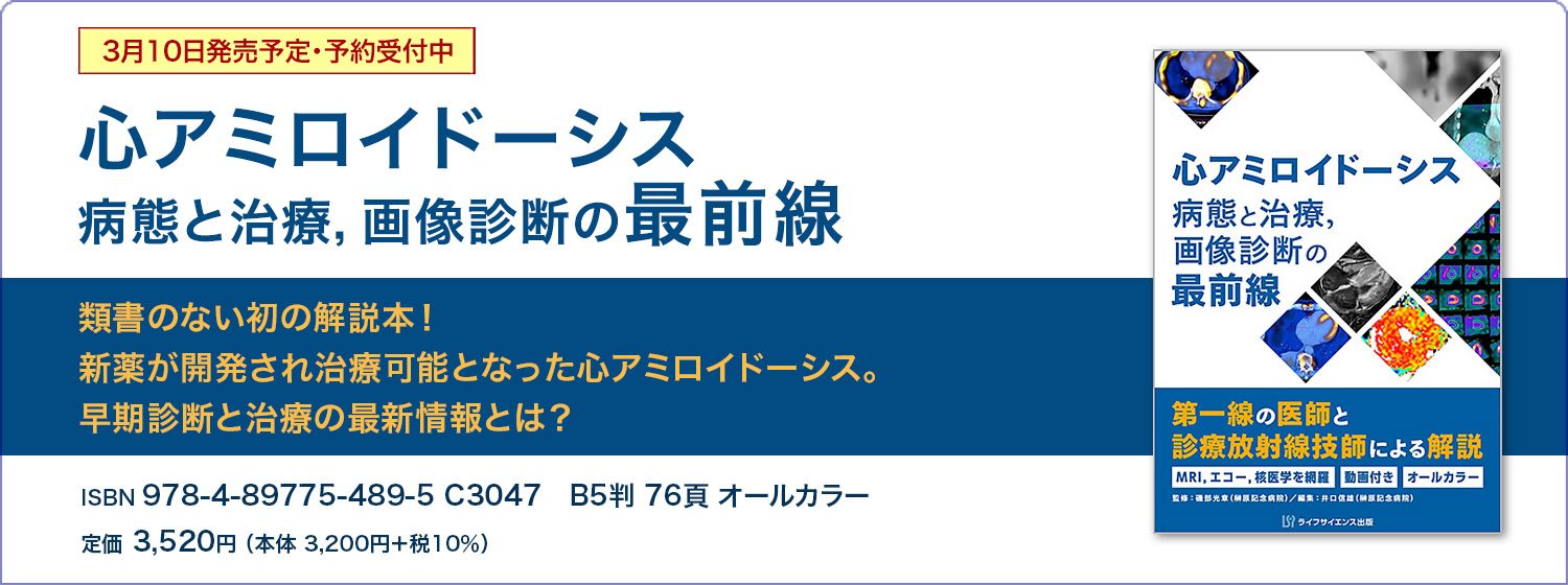 心アミロイドーシス　病態と治療，画像診断の最前線