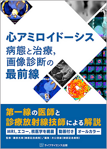 心アミロイドーシス　病態と治療，画像診断の最前線